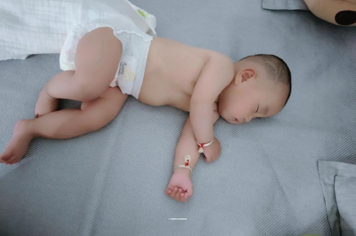 双峰六个月宝宝眼睛散光